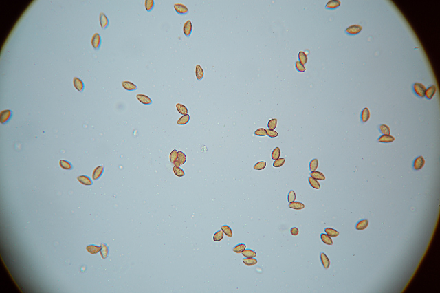 Messa a punto del microscopio